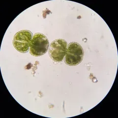 Cosmarium dentatum thumbnail 3