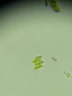 Tetradesmus dimorphus thumbnail 4