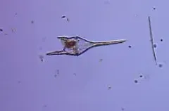 Tripos lineatus thumbnail 3