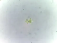 Selenastrum bibraianum thumbnail 3