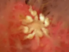 Tanystylum grossifemorum thumbnail 4