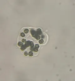 Microcystis wesenbergii thumbnail 4