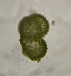 Woronichinia naegeliana thumbnail 2