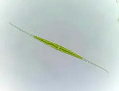 Closterium kuetzingii thumbnail 3