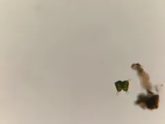 Staurastrum longispinum thumbnail 3