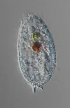 Coleps hirtus thumbnail 2