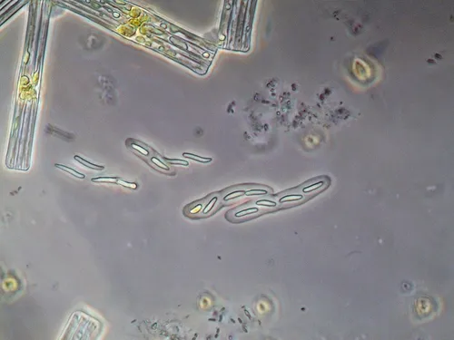 Rhabdoderma lineare