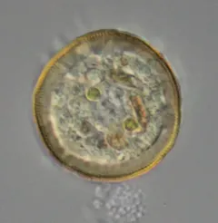 Arcella hemisphaerica thumbnail 3