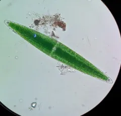Closterium lunula thumbnail 3
