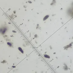 Hysterobrevium mori thumbnail 1