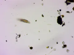 Macrotrachela plicata thumbnail 2