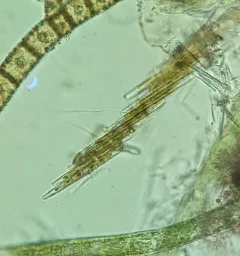carpenter's rule diatom thumbnail 4