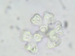 Gomphosphaeria aponina thumbnail 2