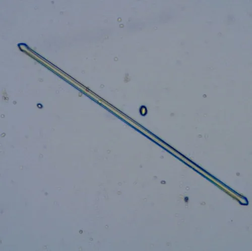 Ulnaria capitata