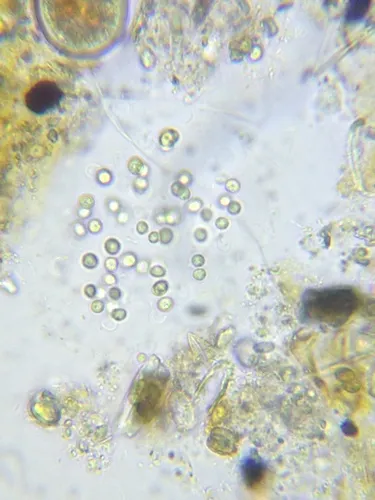 Aphanocapsa grevillei
