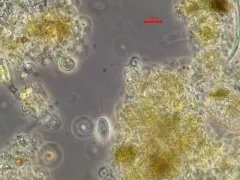 Cyclidium glaucoma thumbnail 3