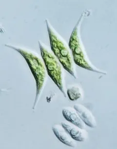 Tetradesmus lagerheimii thumbnail 2