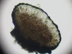 Abrothallus cetrariae thumbnail 2