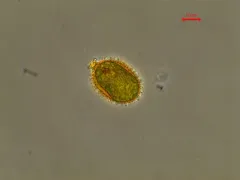 Trachelomonas hispida thumbnail 2