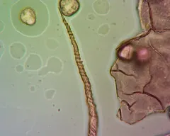 Trichia crateriformis thumbnail 3