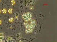 Kirchneriella lunaris thumbnail 2