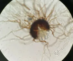 Golovinomyces hydrophyllacearum thumbnail 3