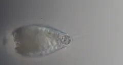 Cyphoderia ampulla thumbnail 3