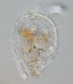 Euglypha strigosa thumbnail 2