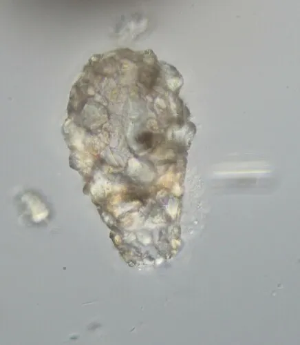Difflugia bryophila