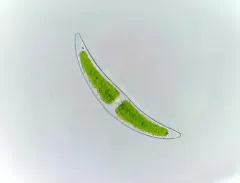 Closterium moniliferum thumbnail 4