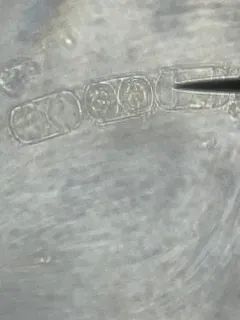 Melosira inflexa thumbnail 2