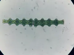 Pleurotaenium nodosum thumbnail 1