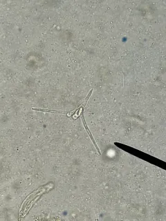 Tetracladium marchalianum thumbnail 3