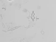 Staurosira binodis thumbnail 3