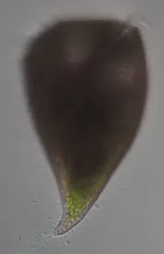 Stentor amethystinus thumbnail 3