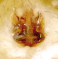 Agroeca pratensis thumbnail 2