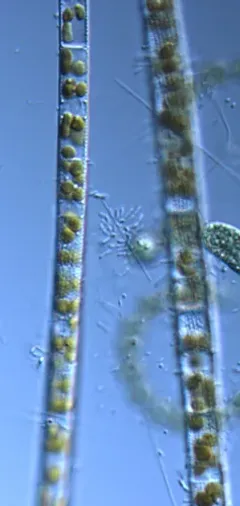 Aulacoseira granulata thumbnail 4