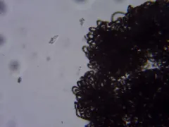 Dolichospermum lemmermannii thumbnail 2