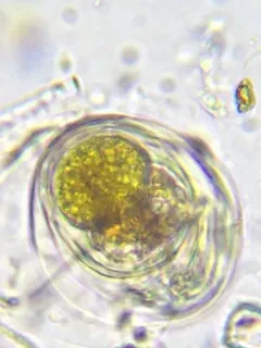 Gloeodinium montanum thumbnail 2