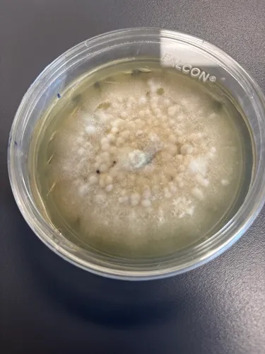 Microsphaeropsis olivacea