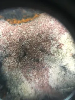 Hymenelia epulotica thumbnail 2