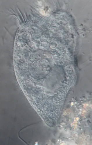 Stentor elegans