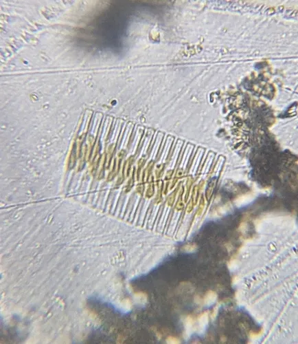 Fragilaria crotonensis