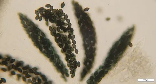 Podospora collapsa