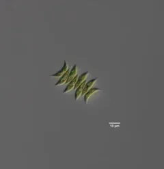 Tetradesmus dimorphus thumbnail 1