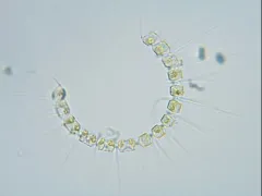 Chaetoceros curvisetus thumbnail 2
