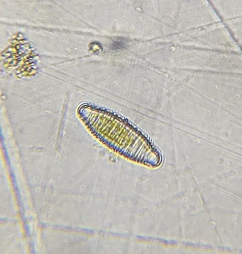 Diatoma vulgaris