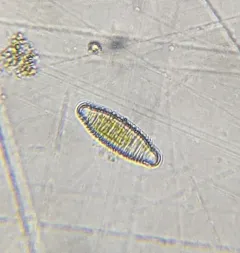 Diatoma vulgaris thumbnail 1