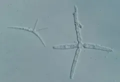 Alatospora acuminata thumbnail 1