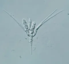 Tetracladium setigerum thumbnail 1